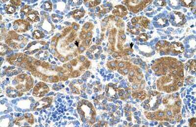 Immunohistochemistry-Paraffin: ATIC Antibody [NBP1-56916]