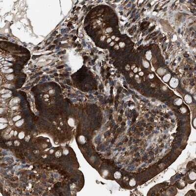 Immunohistochemistry-Paraffin: ATIC Antibody [NBP1-89192]