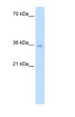 Western Blot: ATIC Antibody [NBP1-56916]