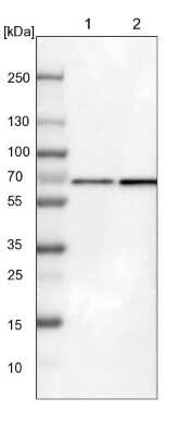 Western Blot: ATIC Antibody [NBP1-89192]