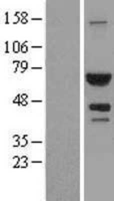 Western Blot: ATIC Overexpression Lysate [NBL1-07801]