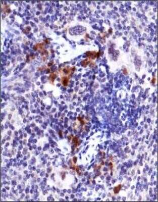 Immunohistochemistry: ATM Antibody (10H11.E12) - Azide and BSA Free [NBP2-80586]