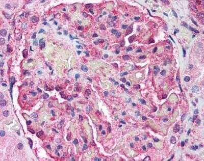 Immunohistochemistry-Paraffin: ATM Antibody (2C1) [NB100-309]