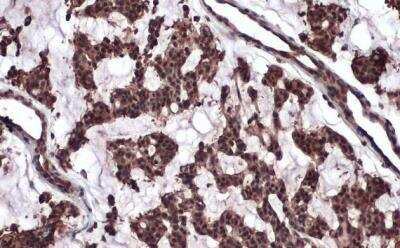 Immunohistochemistry-Paraffin: ATM Antibody (2C1) [NB100-309]