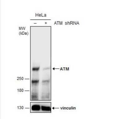 Knockdown Validated: ATM Antibody (2C1) [NB100-309]