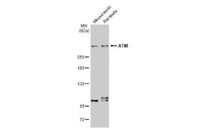 Western Blot: ATM Antibody (2C1-RB) [NBP3-13655]