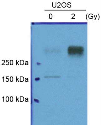 Western Blot: ATM Antibody (2C1) [NB100-309]