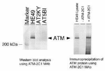 Western Blot: ATM Antibody (2C1) [NB100-309]