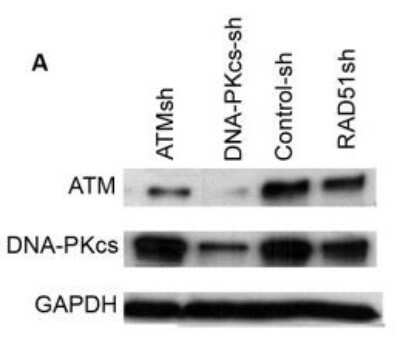 Knockdown Validated: ATM Antibody (2C1) [NB100-309]