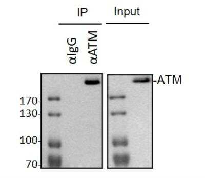 Immunoprecipitation: ATM Antibody (2C1) [NB100-309]