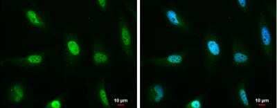 Immunocytochemistry/ Immunofluorescence: ATM Antibody (5C2) [NB100-220]