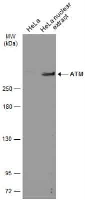 Western Blot: ATM Antibody (5C2) [NB100-220]