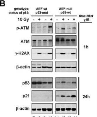 Western Blot: ATM Antibody (5C2) [NB100-220]
