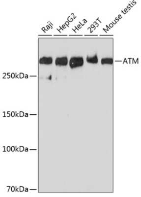 Western Blot: ATM Antibody (6P6C6) [NBP3-15838]