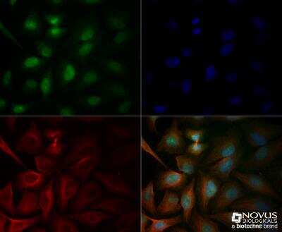 Immunocytochemistry/ Immunofluorescence: ATM Antibody [NB100-104]