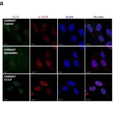 Immunocytochemistry/ Immunofluorescence: ATM Antibody [NB100-104]