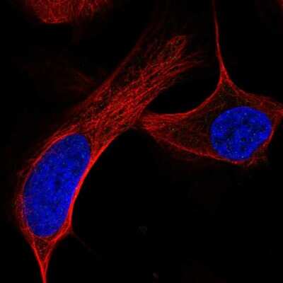 Immunocytochemistry/ Immunofluorescence: ATM Antibody [NBP2-57867]