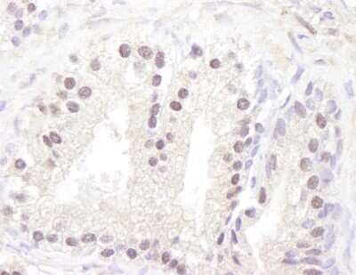 Immunohistochemistry: ATM Antibody [NB100-678]