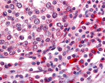 Immunohistochemistry-Paraffin: ATM Antibody [NB100-104]