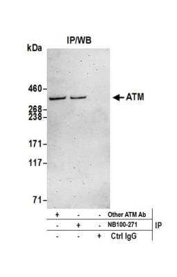 Immunoprecipitation: ATM Antibody [NB100-271]