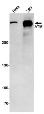 Western Blot: ATM Antibody (S08-8H3) [NBP3-20086]