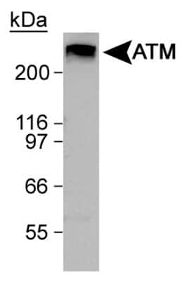 Western Blot: ATM Antibody [NB100-104]