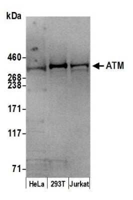 Western Blot: ATM Antibody [NB100-271]