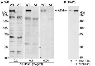 Western Blot: ATM Antibody [NB100-678]