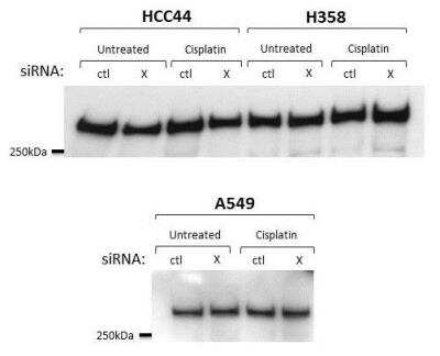 Western Blot: ATM Antibody [NB100-678]