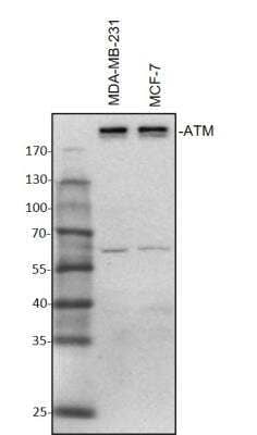 Western Blot: ATM Antibody [NB100-678]