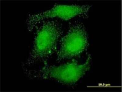 Immunocytochemistry/ Immunofluorescence: ATN1 Antibody (2C10) [H00001822-M01]