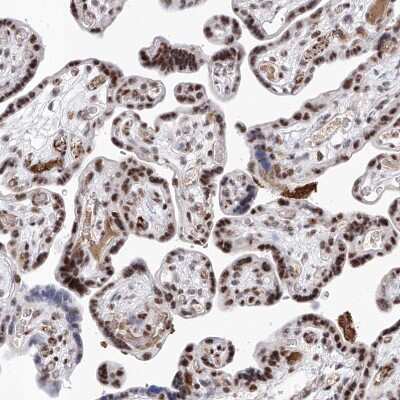 Immunohistochemistry-Paraffin: ATN1 Antibody [NBP1-90044]