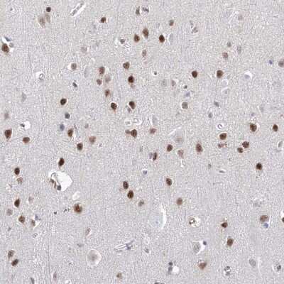 Immunohistochemistry-Paraffin: ATN1 Antibody [NBP1-90044]