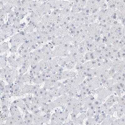 Immunohistochemistry-Paraffin: ATN1 Antibody [NBP1-90044]