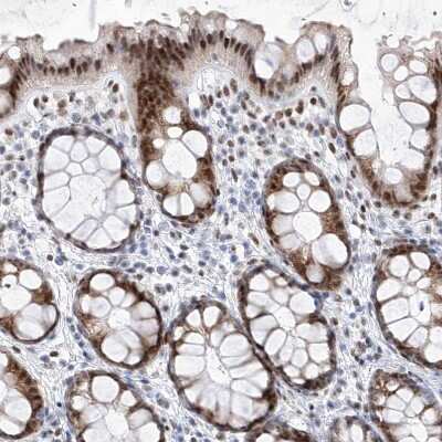 Immunohistochemistry-Paraffin: ATN1 Antibody [NBP1-90044]