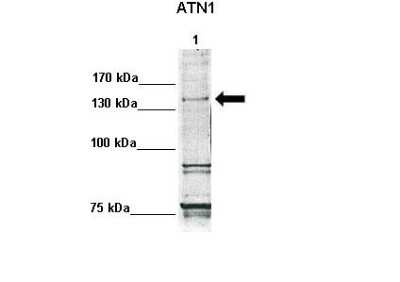 Western Blot: ATN1 Antibody [NBP2-87052]
