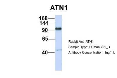 Western Blot: ATN1 Antibody [NBP2-87052]