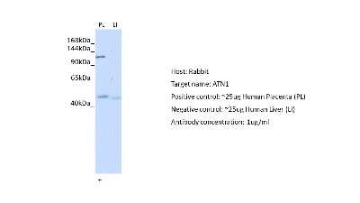 Western Blot: ATN1 Antibody [NBP2-87052]