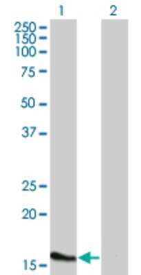 Western Blot: ATOH7 Antibody (1E5) [H00220202-M02]