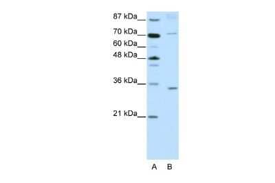 Western Blot: ATOH8 Antibody [NBP2-84478]