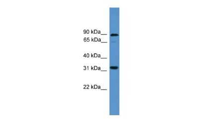 Western Blot: ATOH8 Antibody [NBP2-84479]