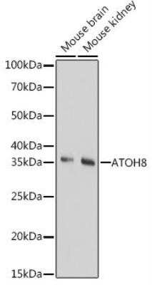 Western Blot: ATOH8 AntibodyAzide and BSA Free [NBP2-92353]