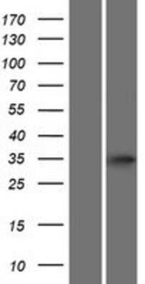 Western Blot: ATOH8 Overexpression Lysate [NBP2-05965]