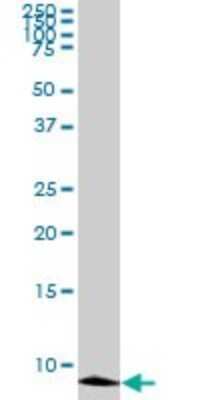 Western Blot: ATOX1 Antibody (2E6) [H00000475-M01]
