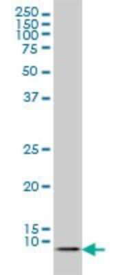 Western Blot: ATOX1 Antibody (2E6) [H00000475-M01]