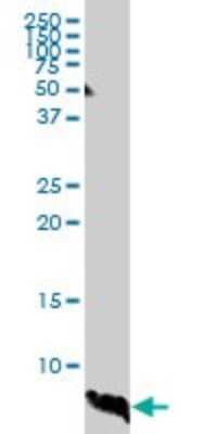 Western Blot: ATOX1 Antibody (2E6) [H00000475-M01]