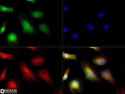 Immunocytochemistry/ Immunofluorescence: ATOX1 Antibody [NBP1-06611]