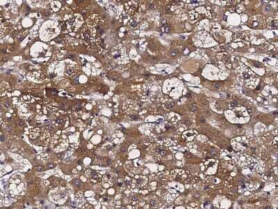 Immunohistochemistry-Paraffin: ATOX1 Antibody [NBP2-97082]