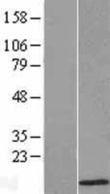 Western Blot: ATOX1 Overexpression Lysate [NBL1-07805]