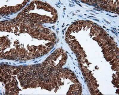 Immunohistochemistry-Paraffin: ATP Citrate Lyase Antibody (OTI3G8) [NBP2-02410]